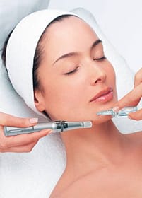 Bella Noor Skincare Services microneedling